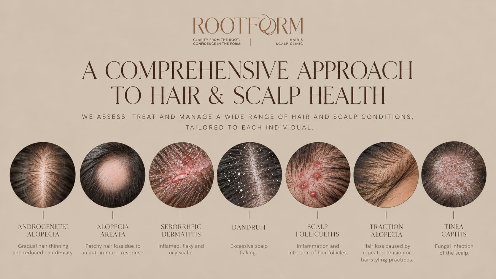 Scalp Diseases: Causes, Symptoms and Care Guidelines