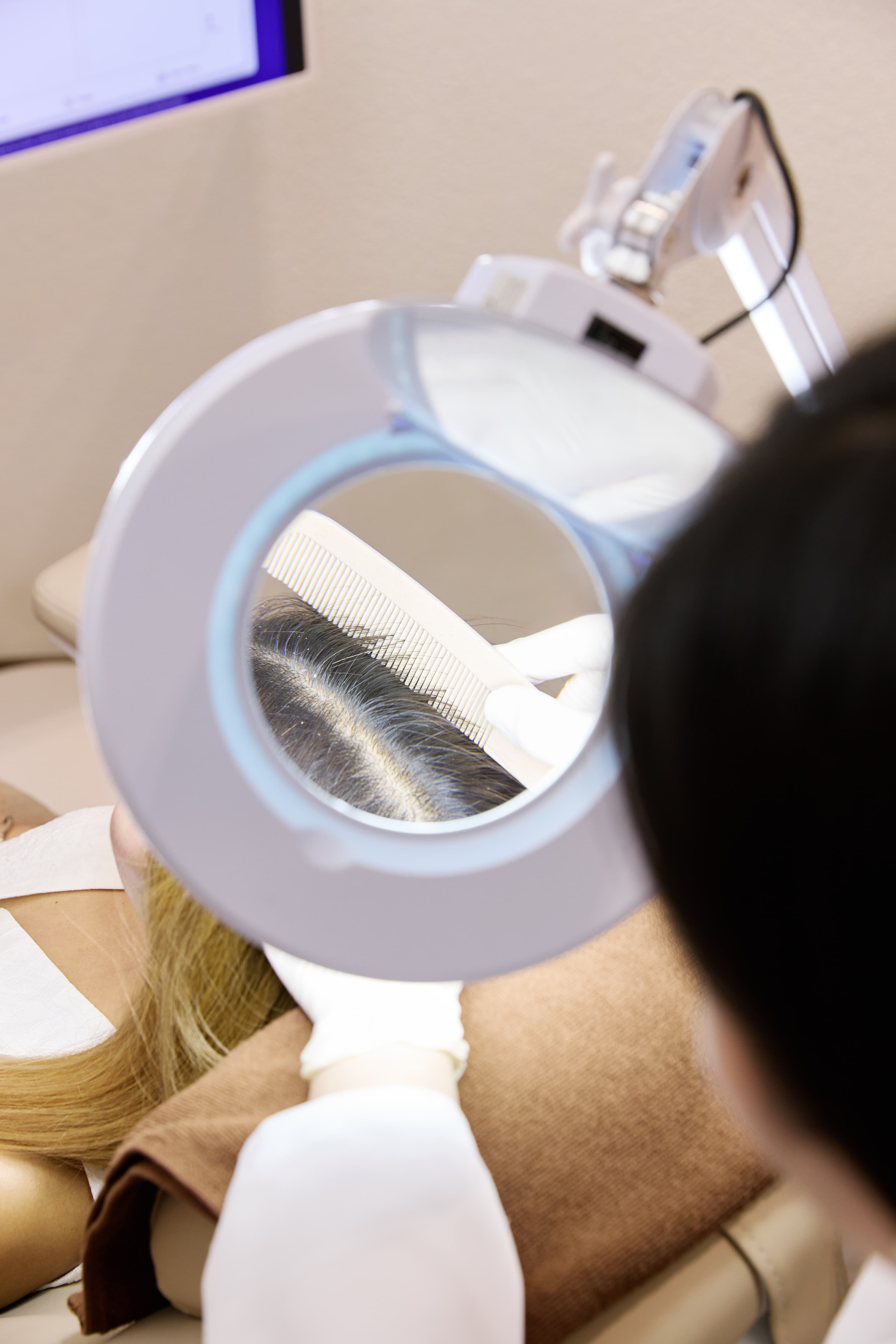 What Causes Hair Loss and Hair Thinning?
